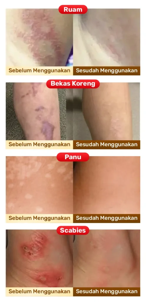 sabun waji – Minyak Ajaib Waji